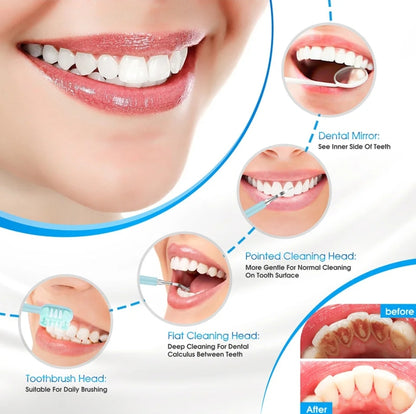 Electric toothbrush whitening